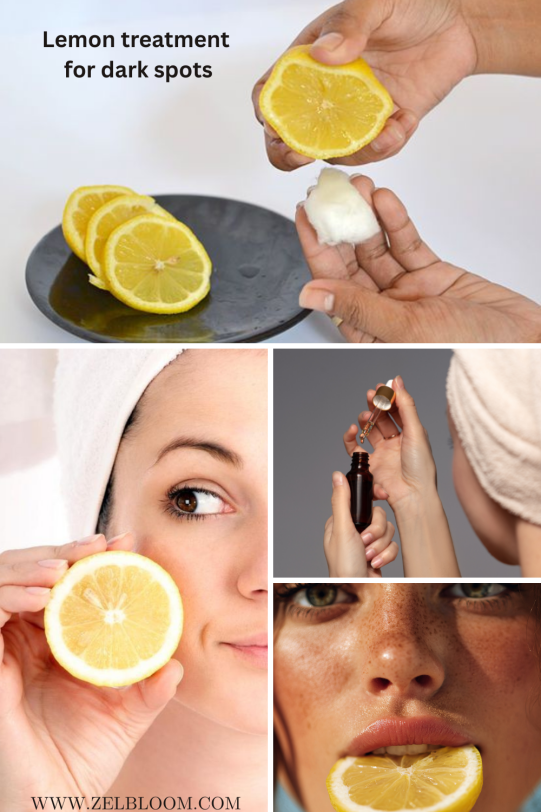 lemon treatment for lighten dark spots remedies