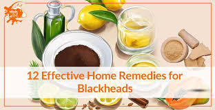 natural treatment for blackheads