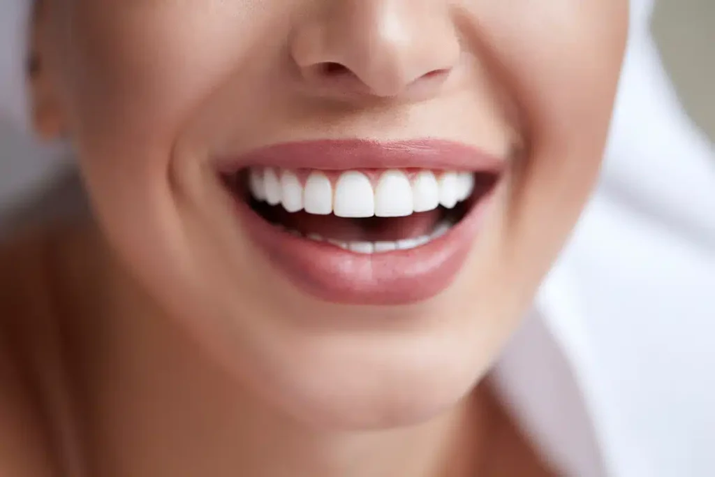 natural home remedies for teeth whitening